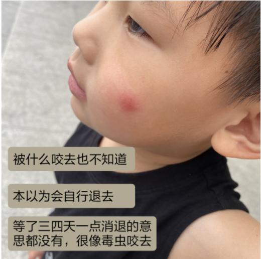 【驱蚊止痒】季德胜天然艾叶蚊虫叮咬止痒喷雾喷剂 非花露水产品健肤水30ml 商品图5