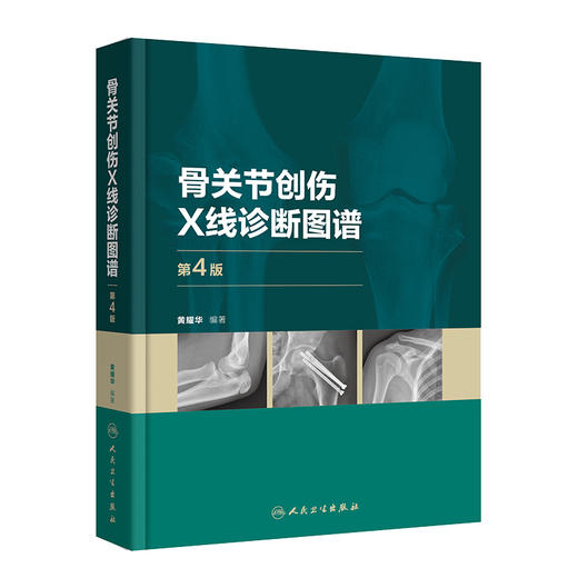 骨关节创伤X线诊断图谱 第4版 黄耀华 骨外科学创伤类型鉴别诊断常见骨关节创伤后遗症及并发症 人民卫生出版社9787117328548 商品图1