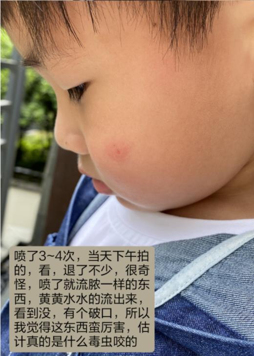 【驱蚊止痒】季德胜天然艾叶蚊虫叮咬止痒喷雾喷剂 非花露水产品健肤水30ml 商品图7