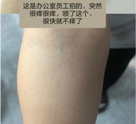 【驱蚊止痒】季德胜天然艾叶蚊虫叮咬止痒喷雾喷剂 非花露水产品健肤水30ml 商品图4