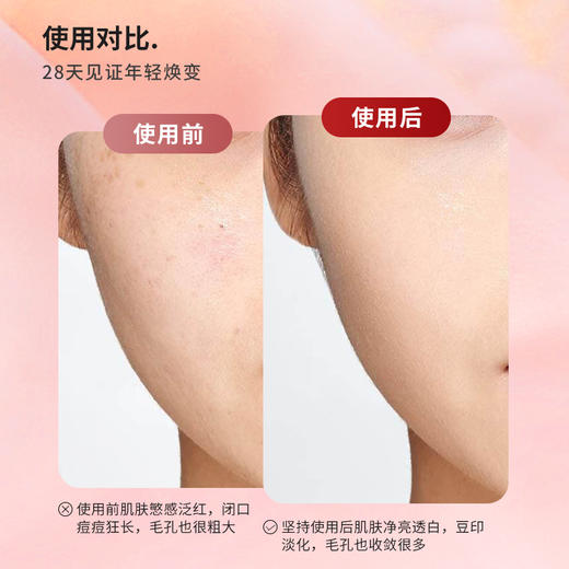 资生堂红腰子精华100ml  26年下半年 介意勿拍 商品图3