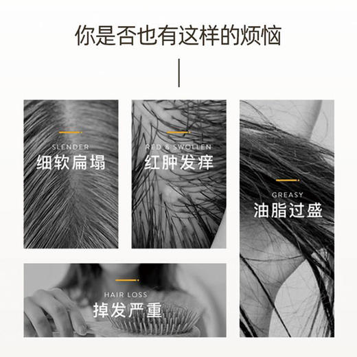 【第2瓶半价】MVO青蒿石斛丰盈洗发水你身边的除螨去油好帮手99.8%除螨率石斛专利去屑止痒清新香味 商品图1