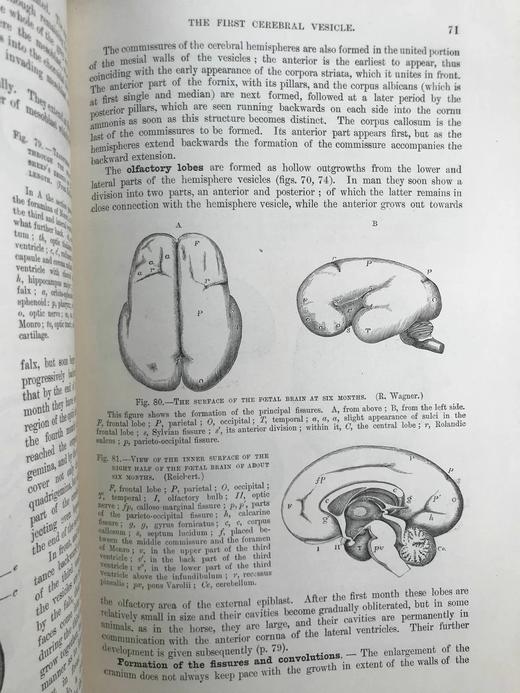 1898年 奎恩解剖学要点（卷1，分2册） 近700幅插图 漆布精装16开 商品图9