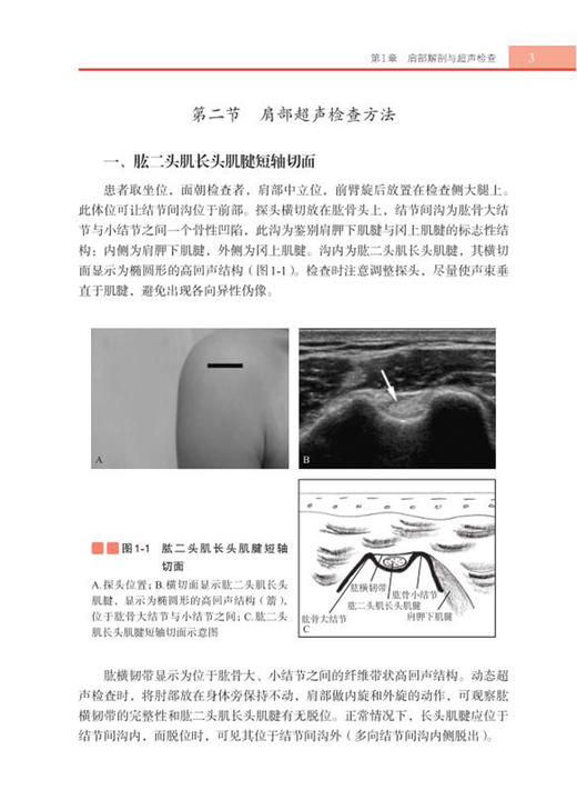正版 四肢肌骨超声入门图解 第2版 王月香 编著 四肢肌肉疾病骨疾病超声波诊断临床治疗解剖图谱 科学出版社9787030678652 商品图4