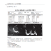  心血管复杂冠脉介入治疗病例解析 会对冠脉介入医生有所帮助的医学书籍 杨清 梁春坡 吴成程 主编 9787030665218科学出版社 商品缩略图4
