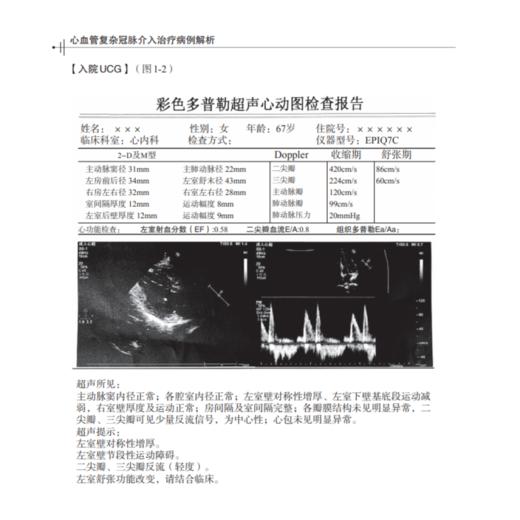  心血管复杂冠脉介入治疗病例解析 会对冠脉介入医生有所帮助的医学书籍 杨清 梁春坡 吴成程 主编 9787030665218科学出版社 商品图4