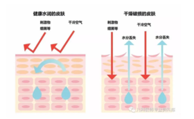  干货丨湿疹、痱子怎么区分？今天教你一秒分清，轻松护理！ 