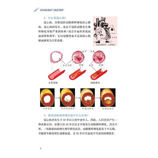 冠心病家庭与病房调护（第二版）/浙江省医学会公共卫生学分会科普丛书/郭航远/陈利坚//吕巧霞/余瑜/浙江大学出版社 商品图4