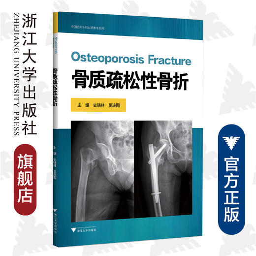 骨质疏松性骨折/中国临床专科医师参考系列/史晓林/吴连国/浙江大学出版社 商品图0