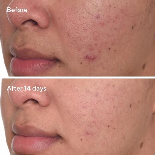 美国 Murad慕拉得 黄金果酸VC光感双管面部精华 30ml 商品图4