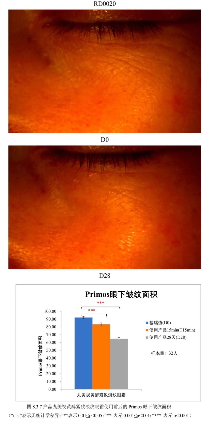 一个连法令纹都能淡的东西,618 买它!(不是医美)