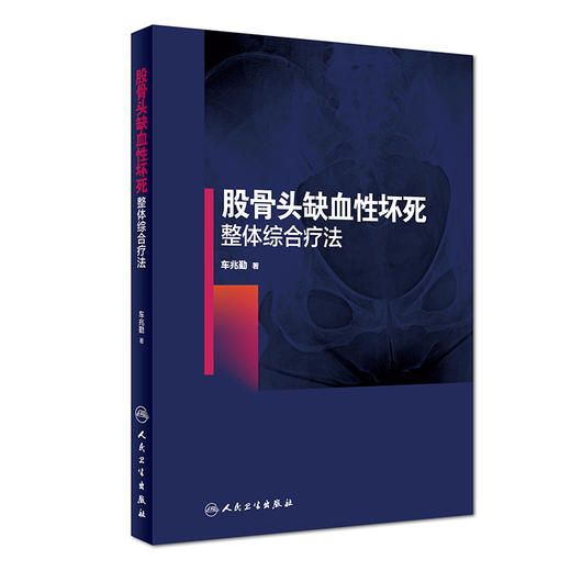 (仓发) 股骨头缺血性坏死整体综合疗法/人民卫生出版社/车兆勤/9787117268110 商品图0