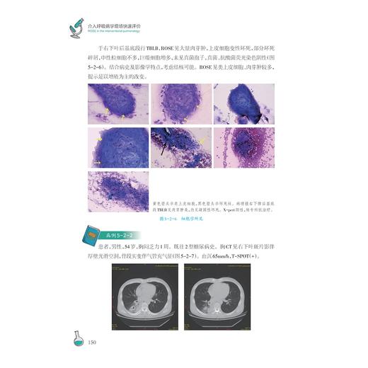 介入呼吸病学现场快速评价(精)/金伟中/浙江大学出版社 商品图4