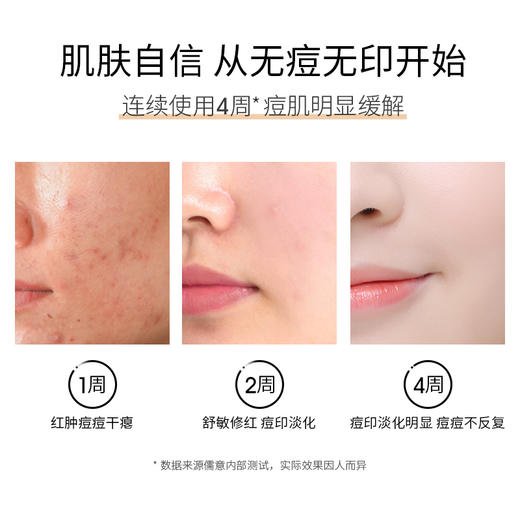 儒意寡肽精华液15ml 祛痘印 修复淡化痘印痘坑男女士美白痘疤脸上精华液  | 儒意官方商城 商品图4