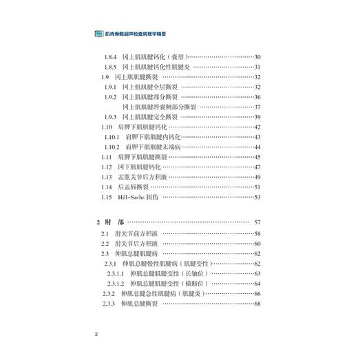 肌肉骨骼超声检查病理学精要(精)/运动系统常见疾病肌骨超声诊断学系列/陈作兵/王亭贵/陈文翔/浙江大学出版社 商品图5