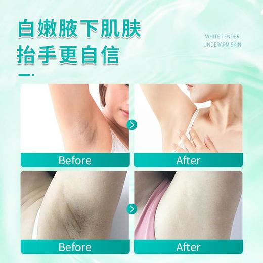【保密发货！2瓶立减20】澳洲原装进囗，腋臭狐味多汗告别 白嫩腋下，天然温和干爽清淡 商品图4