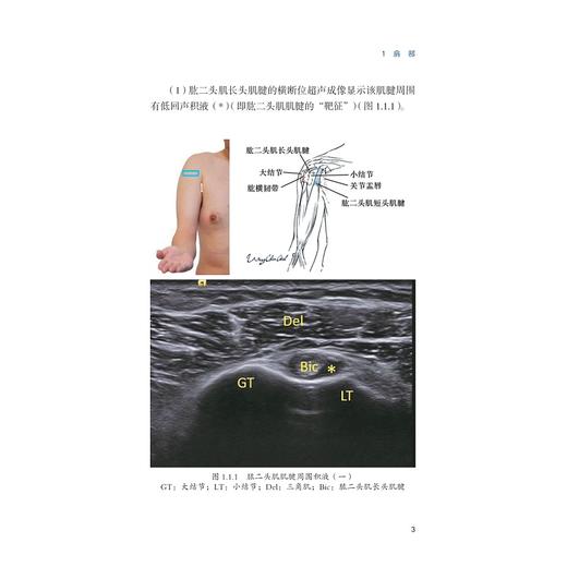 肌肉骨骼超声检查病理学精要(精)/运动系统常见疾病肌骨超声诊断学系列/陈作兵/王亭贵/陈文翔/浙江大学出版社 商品图2