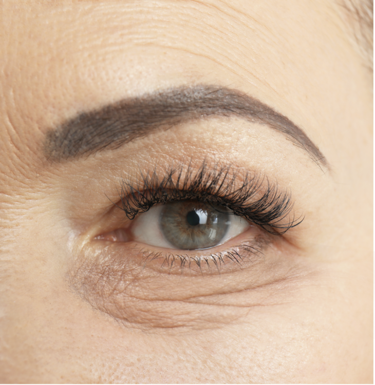 一个连法令纹都能淡的东西,618 买它!(不是医美)