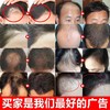 南京同仁堂防脱育发液秃头密发胡须增发液护发修护发根精华液 商品缩略图1
