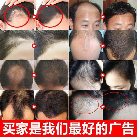 南京同仁堂防脱育发液秃头密发胡须增发液护发修护发根精华液 商品图1