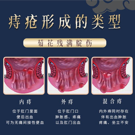 南京同仁堂腾中牌乳膏 大品牌 好品质 解决你的后股之忧 一擦即爽，「痔」在必除 10种中药草本 0添加 商品图3