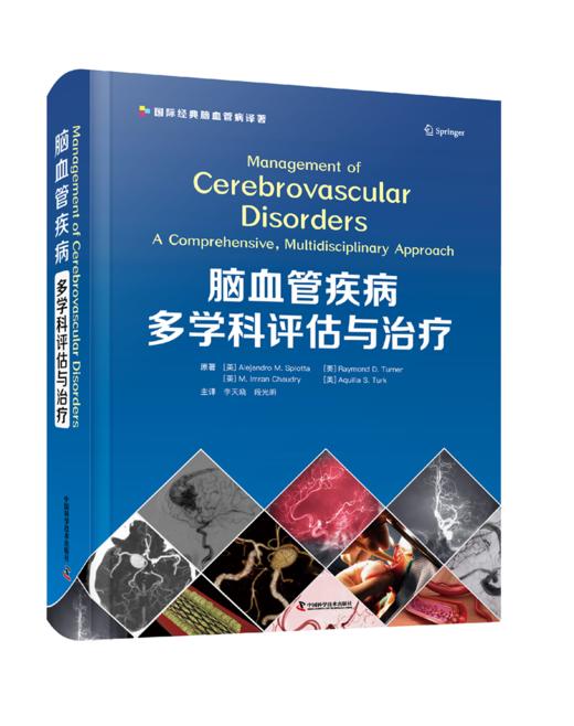 脑血管疾病多学科评估与治liao 商品图0