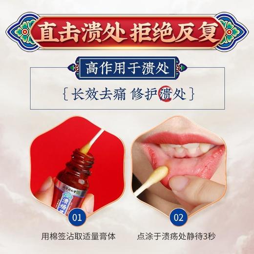 南京同仁堂绿金家园溃疡灵针对口腔溃疡专业清火缓解口腔上火中药配方直击溃处 商品图2