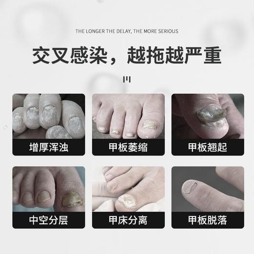 【保密发货！】美国原装进囗，深层溶箘，快速修复坏甲，助生健康新甲，指甲强韧透亮，告别甲沟不适，天然温和 商品图2