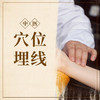 穴位埋线套餐 商品缩略图0