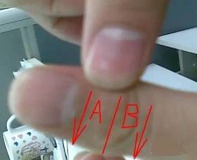  治“打呼噜”的小妙招，人人都能学会 