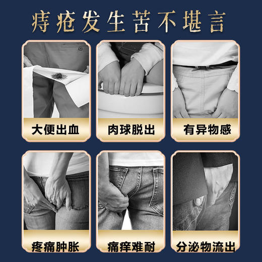 【买2送1】痣爽南京同仁堂腾中牌乳膏大品牌好品质解决你的后股之忧，10种中药草本0添加 商品图1