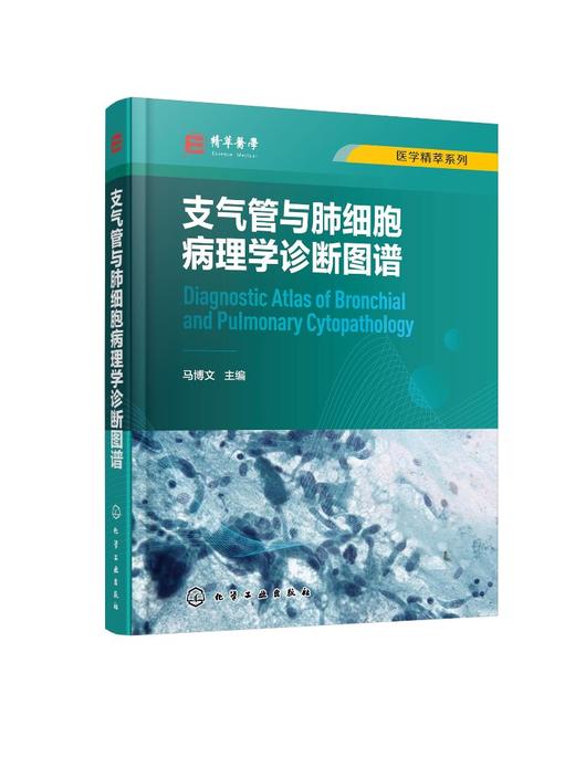 医学精萃系列--支气管与肺细胞病理学诊断图谱 商品图0