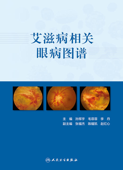 艾滋病相关眼病图谱 9787117313360 2022年6月参考书 商品图1