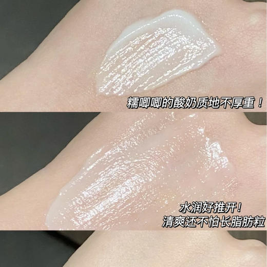 兰蔻新版发光眼霜小黑瓶眼霜15ml 商品图5