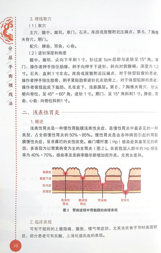 分层平衡埋线法 王佳 编著 针灸学书籍埋线疗法治疗笑话系统疾病运动系统疾病皮肤病中风 配合治疗 中医古籍出版社9787515221618 商品图4