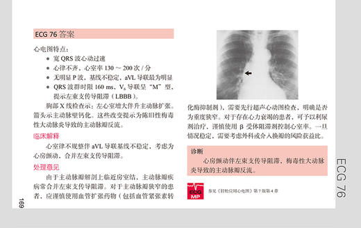 轻松解读心电图 第5版 周益锋 郭继鸿 译 新版第四版升级心电图基础入门提高书籍临床病例 北京大学医学出版社9787565926259 商品图4