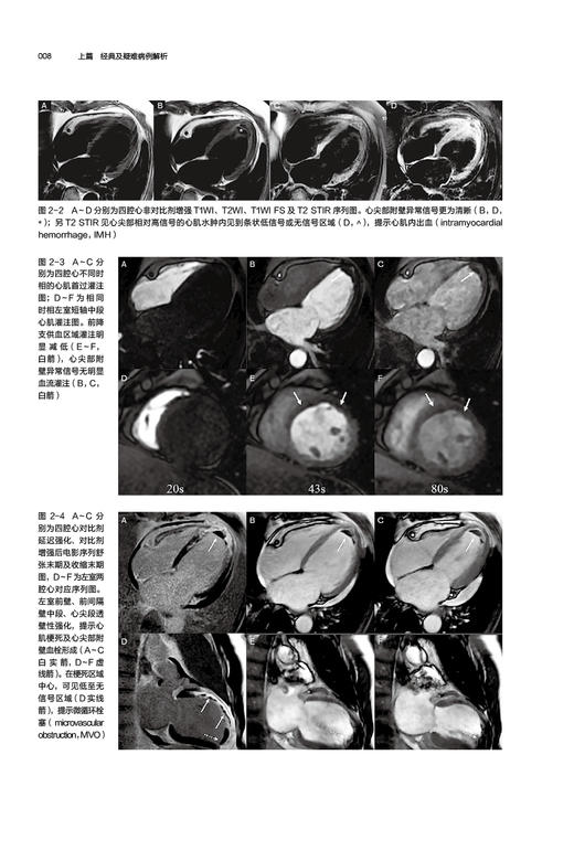 正版 心血管磁共振 病例解析与临床实践 陆敏杰 主编 心脏血管疾病核磁共振成像诊断学影像临床 中国医药科技出版社9787521431513 商品图4