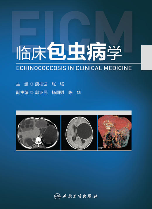 临床包虫病学 2022年6月参考书 9787117330206 商品图1