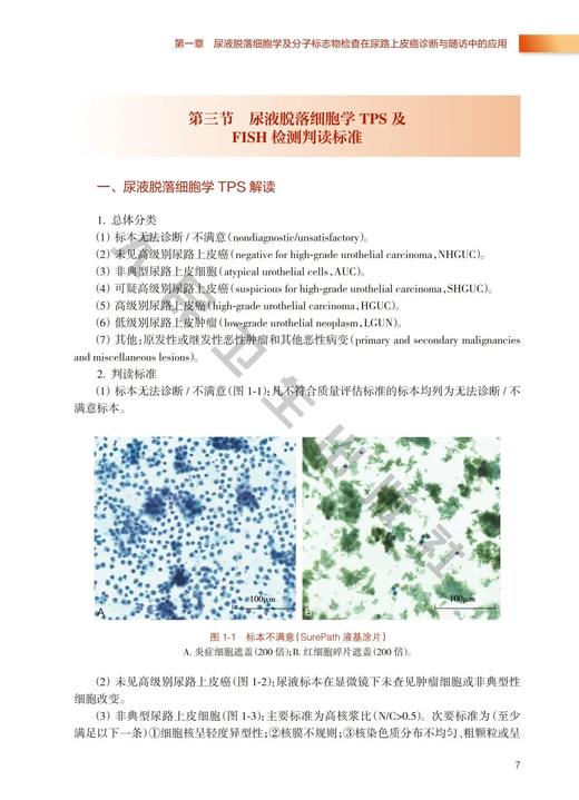 膀胱癌精准诊断与治疗 宋刚 邢念增 主编 临床新技术药物创新肿瘤医学书籍新进展临床实践 人民卫生出版社9787117327992 商品图4