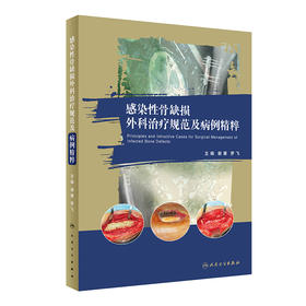 感染性骨缺损外科zhi疗规范及病例精粹 2022年6月参考书 9787117331210