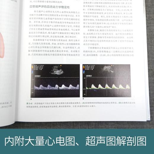 (仓发) 新生儿心脏病学（第3版）/天津科技翻译出版有限公司/9787543340008 商品图2
