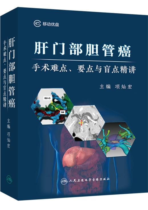 肝门部胆管癌手术难点、要点与盲点精讲【U盘】 商品图0