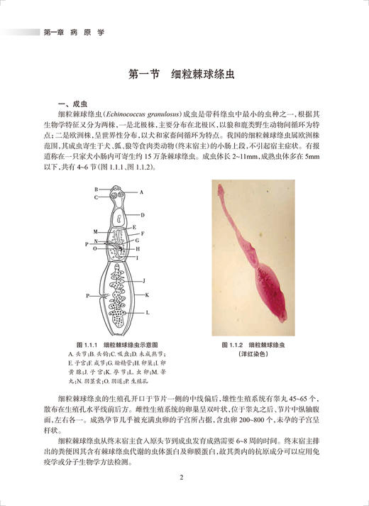 临床包虫病学 唐桂波 张强 编 临床手术治疗异体和自体肝移植影像诊断筛查规范标准研究新进展 人民卫生出版社9787117330206 商品图4