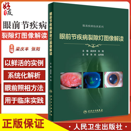 眼前节疾病裂隙灯图像解读 眼表疾病临床系列 梁庆丰 张阳 裂隙灯照相技术眼科学眼前节疾病影像人民卫生出版社9787117330626 商品图0