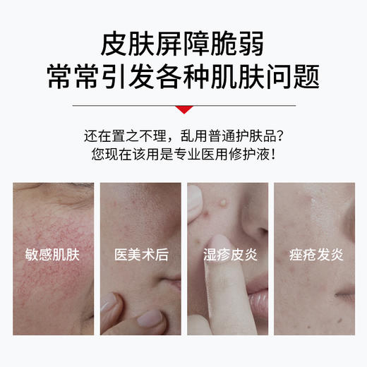 【五一提前购 99元任选3件】美丽莱皮肤修护液缓解皮肤炎症引起的红斑瘙痒刺痛发热干燥脱屑 商品图1