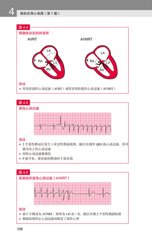 预售3册 轻松学习心电图第9九版+轻松解读心电图第5五版+轻松应用心电图第7七版 郭继鸿新版升级心电图基础入门北京大学医学出版社 商品图4