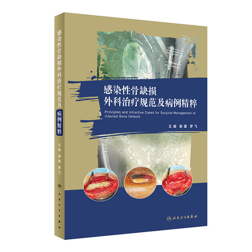 感染性骨缺损外科治疗规范及病例精粹 谢肇 罗飞 临床诊断治疗理念术前评估术前计划病例图谱 人民卫生出版社9787117331210 商品图1