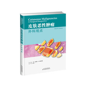 皮肤恶性肿瘤：外科观点 皮肤科 整形外科 肿瘤 手术