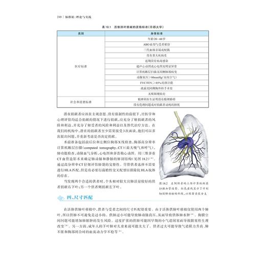 肺移植：理论与实践(精)/浙江大学出版社/韩威力主译/(美)维基T.维格纳斯瓦兰/亚朋德R.加里蒂/引进版/专著 商品图3
