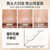 儒意去黑头鼻贴组合20片/盒 收缩毛孔祛黑头粉刺闭口 深层清洁 男女士用黑头贴导出液神器 | 儒意官方商城 商品缩略图3